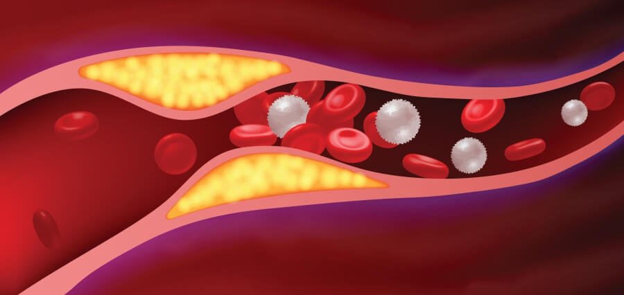 You are currently viewing Heart Disease: The Leading Cause of Death in the US