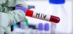 Read more about the article UNAIDS Warns of Alarming HIV Surge by 2029 Without U.S. Support