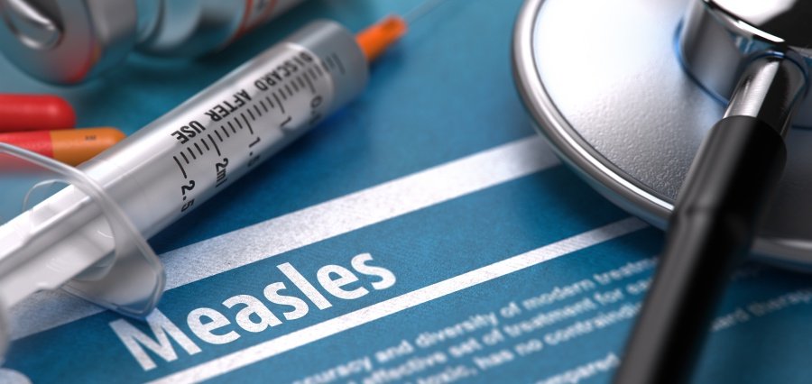 Measles